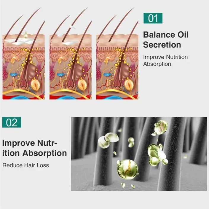 Fast Ginger Hair Growth Serum Anti Hair loss Baldness Regrowth Hair Care Oil Repair Damaged Scalp Treatment For Women Men