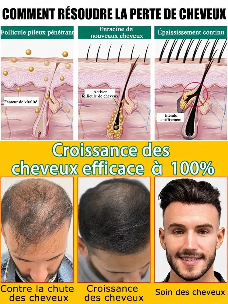 Technology has changed life. Say goodbye to baldness