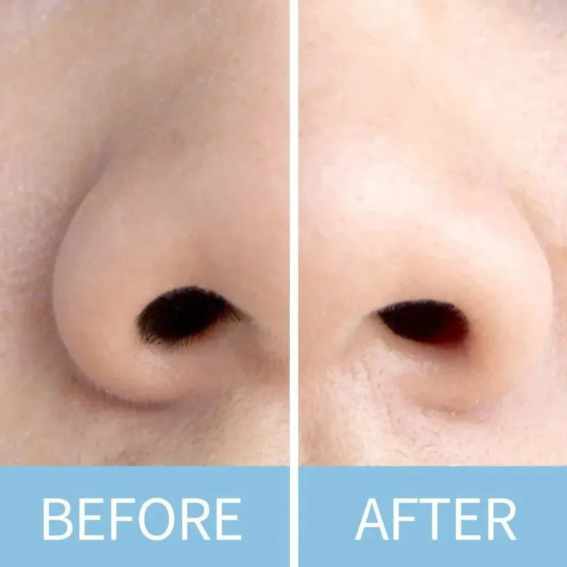 Nose Wax Sticks - 50/1000 Pcs Nose Wax Applicators for Nostril Nasal Cleaning Ear Hair Removal, Effective Depilation