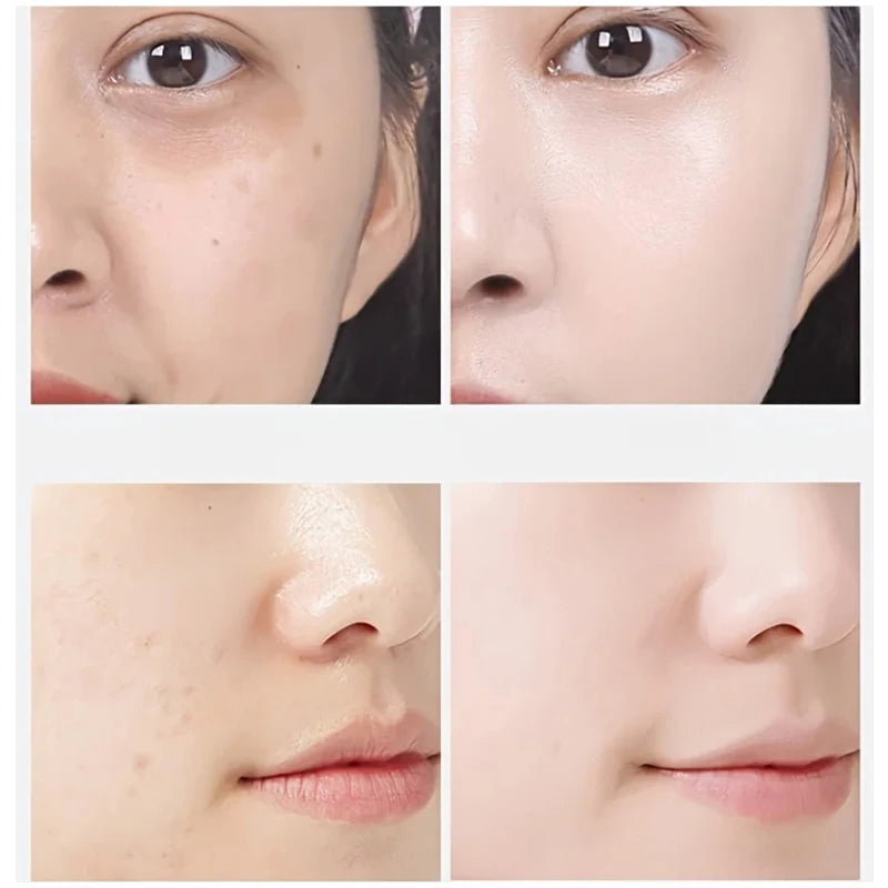 Before and after comparison of facial skin showing reduced blemishes and smoother complexion