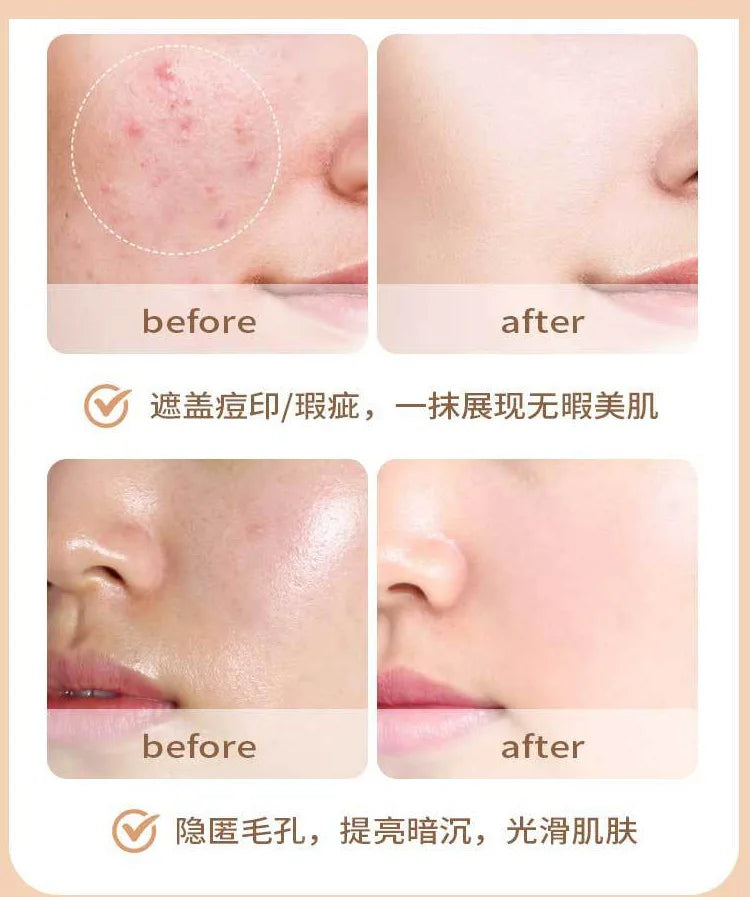 Before and after comparison of facial skin showing reduced redness, smoother texture, minimized pores.
