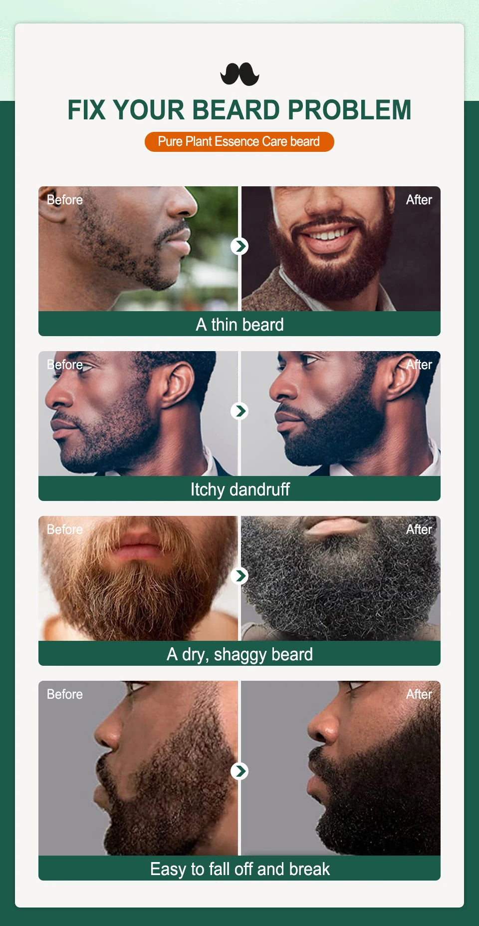 SEVICH Growth Beard Oil for Men Moisturizing Styling Trim Care Thicker Promote Beard Regrowth Strengthen Shine Soften Beard Oil