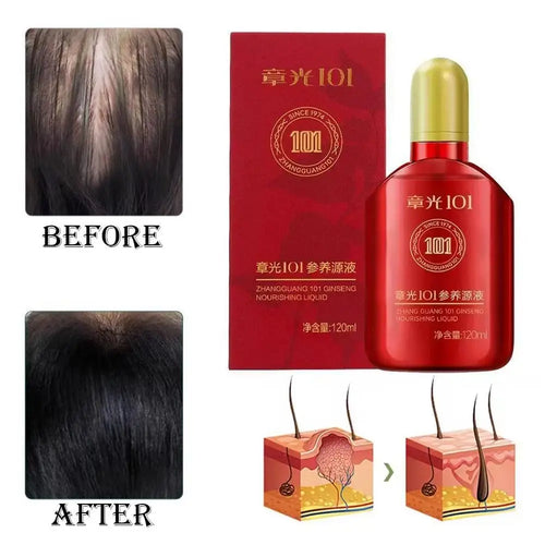 1pcs Hair Tonic Zhangguang 101B Scalp Serum 120ML powerful Chinese medicine therapy Hair Treatment Essence 100% original 2026