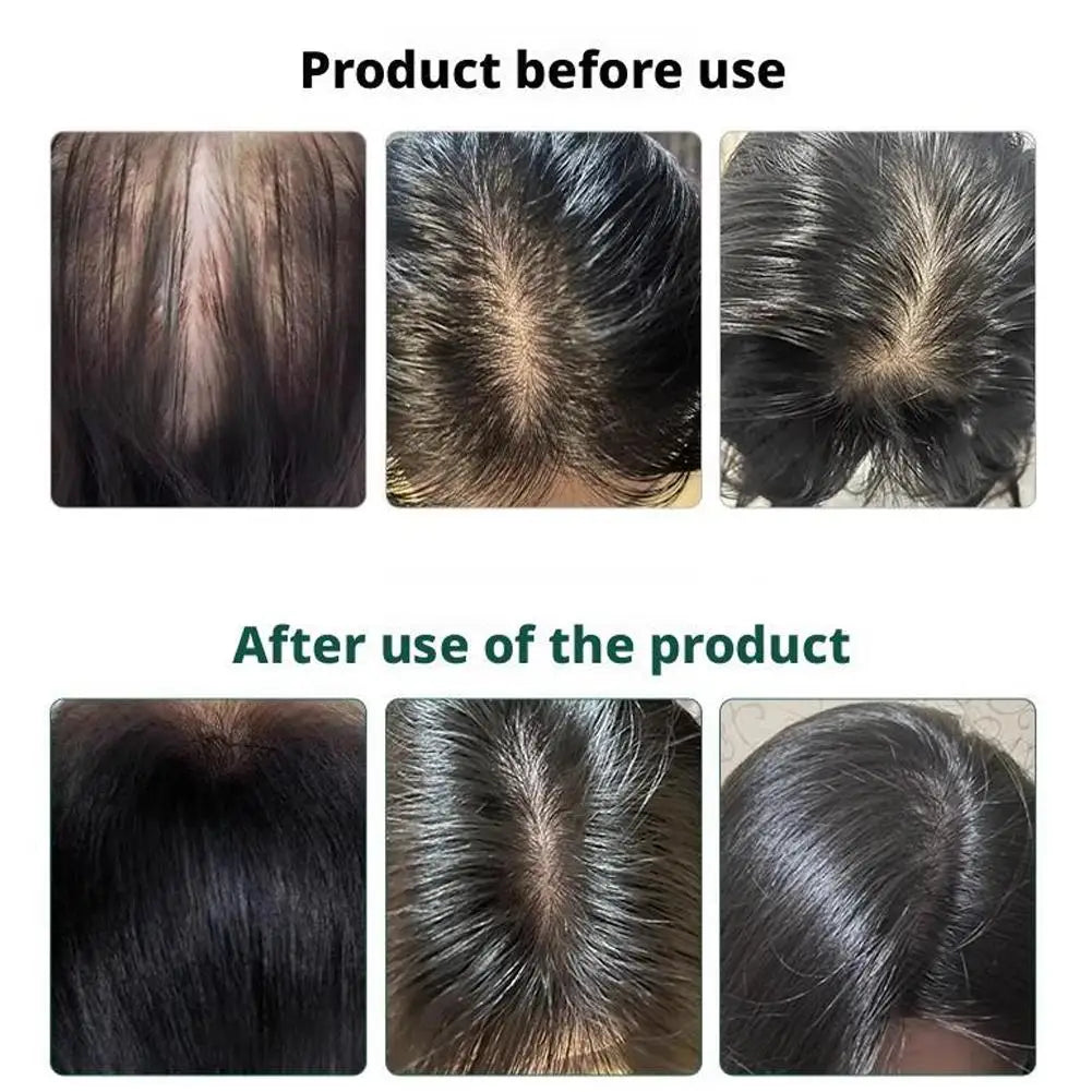 1pcs Hair Tonic Zhangguang 101B Scalp Serum 120ML powerful Chinese medicine therapy Hair Treatment Essence 100% original 2026