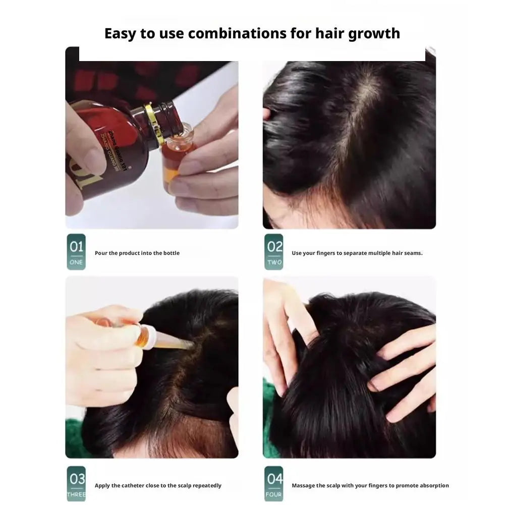 1pcs Hair Tonic Zhangguang 101B Scalp Serum 120ML powerful Chinese medicine therapy Hair Treatment Essence 100% original 2026