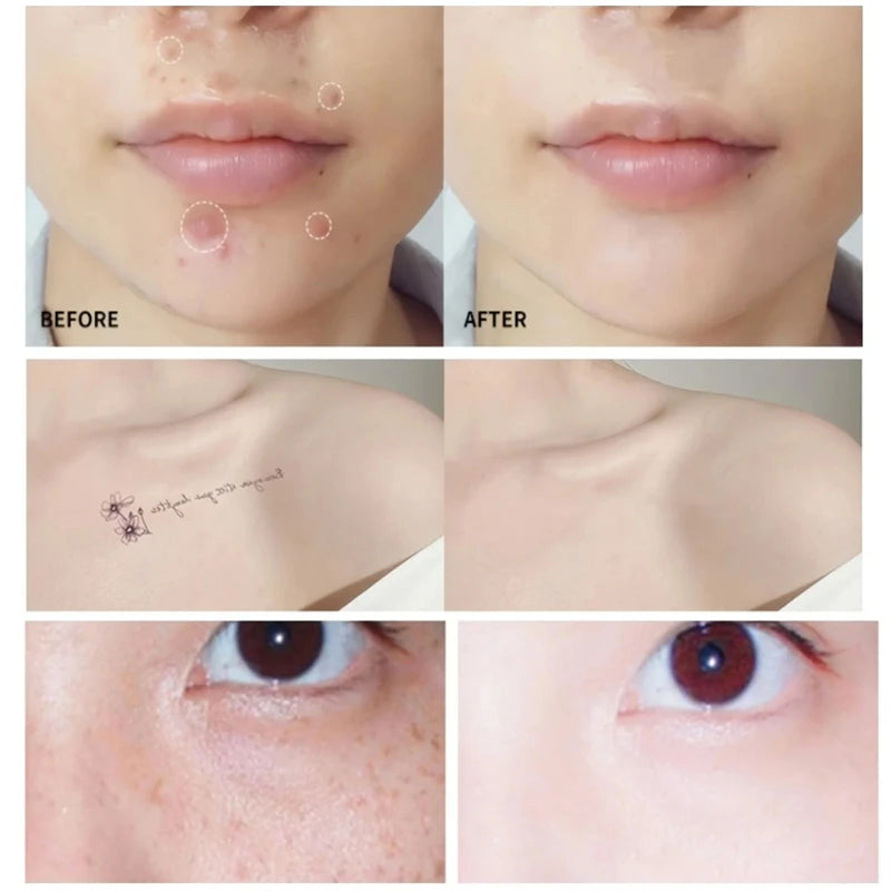 Before and after comparison showing skin blemish coverage, tattoo concealing, and under-eye brightening.