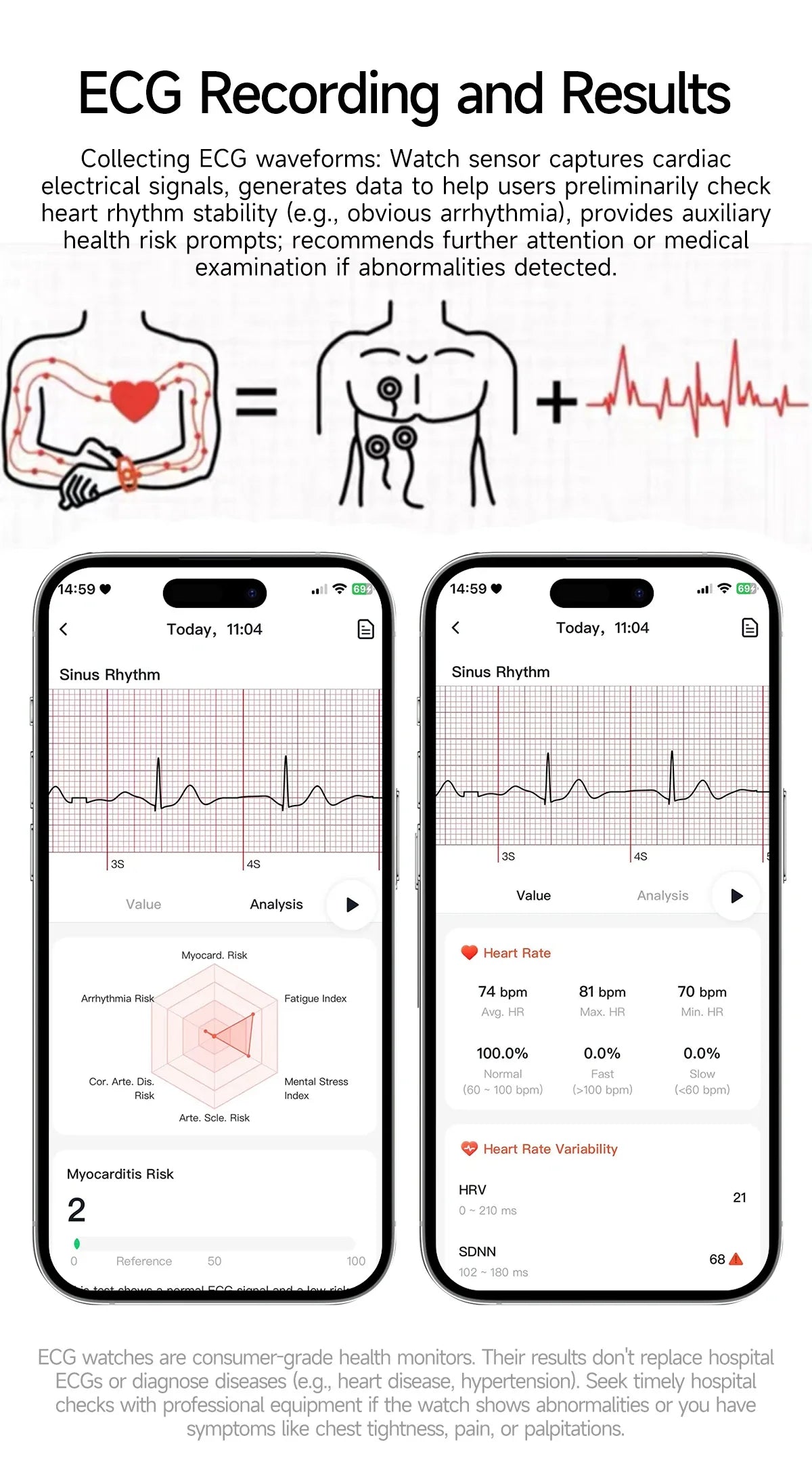 2025Nursing Level Uric Acid Blood lipids Smart Watch Men Blood Pressure ECG+PPG Clock Body Analysis Voice Call Health Smartwatch