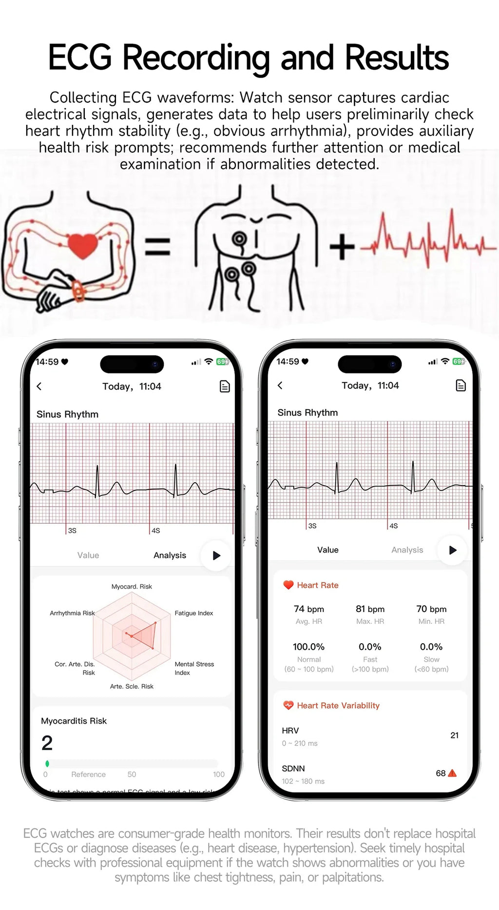 New Accurate Blood Pressure Smart Watch Uric Acid ECG+PPG Blood Oxygen Body Analysis Body Fat LED Flashlight smart watches 2025
