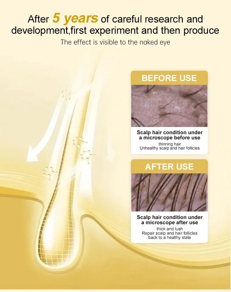 Fast Ginger Hair Growth Serum Anti Hair loss Baldness Regrowth Hair Care Oil Repair Damaged Scalp Treatment For Women Men